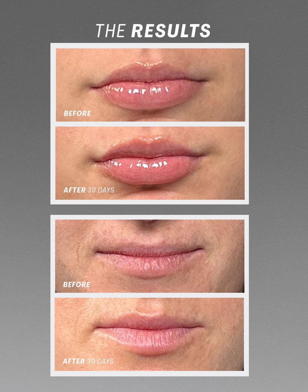 Lip Oasisᵀᴹ Glossy Treatment - obligato